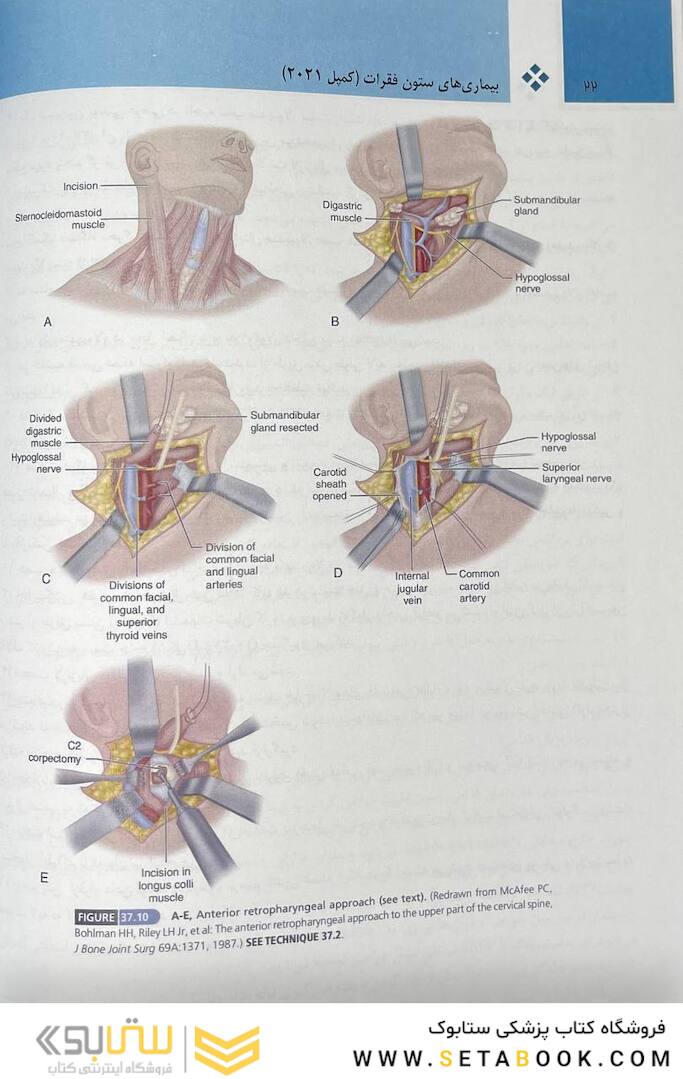 بیماری  های ستون فقرات - کمپل 2021