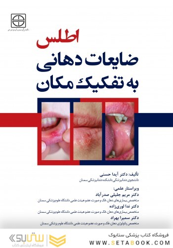 اطلس ضایعات دهانی به تفکیک مکان