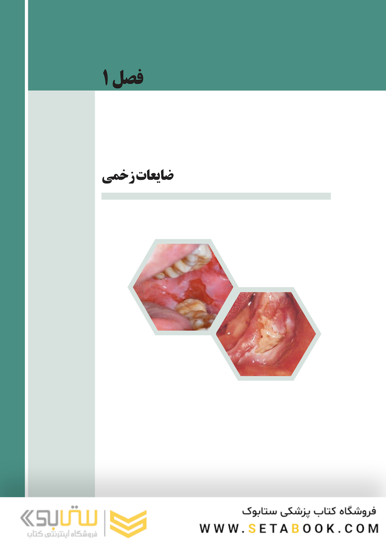اطلس ضایعات دهانی به تفکیک مکان