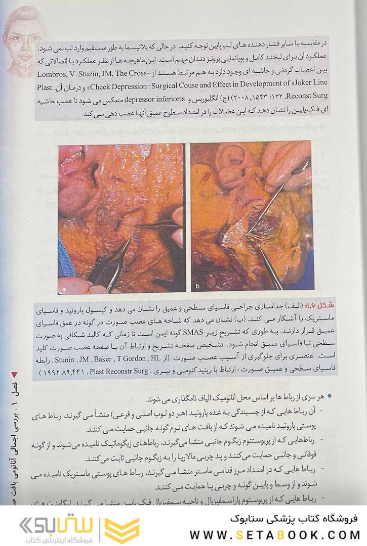 منطقه خطر صورت