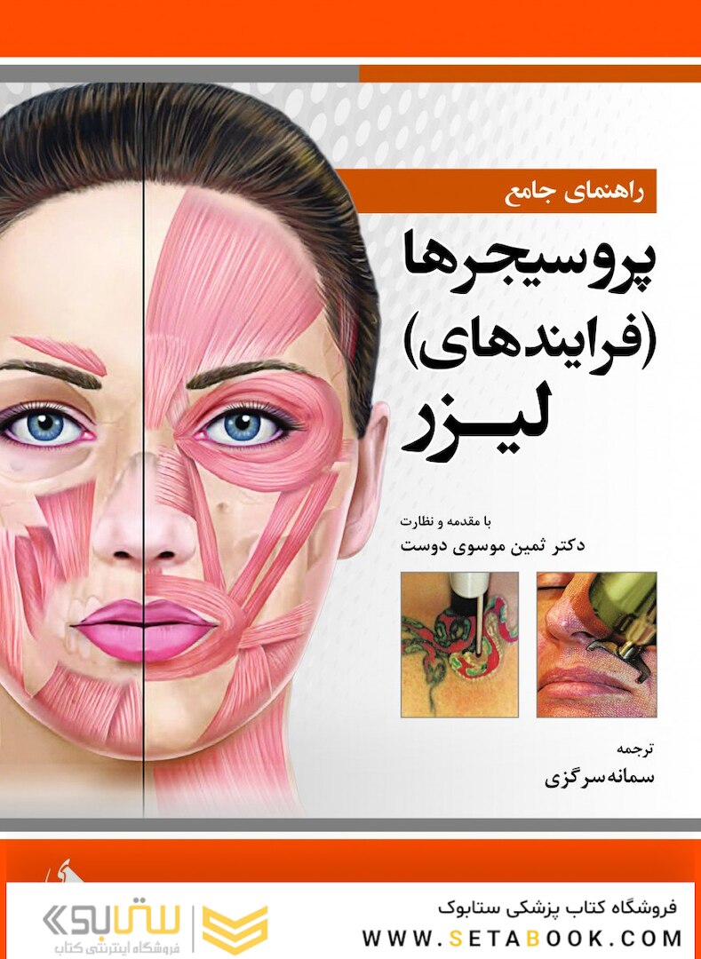 راهنمای جامع پروسیجرها فرایندهای لیزر