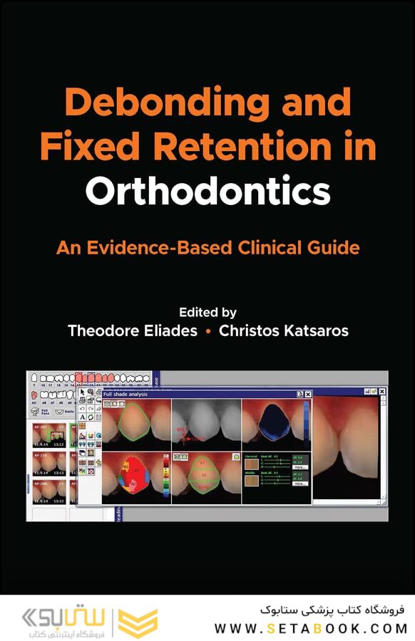 Debonding and Fixed Retention in Orthodontics: An Evidence-Based Clinical Guide 1st Edicion 2024