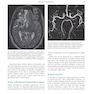Diagnostic Imaging Armstrong 7th Edicion  2013