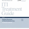 ITI Treatment Guide: Implant Placement in Post-extraction Sites: Treatment Options 3