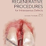 Simplified Regenerative Procedures for Intraosseous Defects