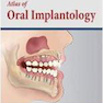 Atlas of Oral Implantology