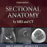 Sectional Anatomy by MRI and CT, 4th Edition2016