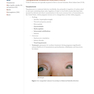 USMLE Step 2 CK Lecture Notes 2022: Pediatrics