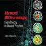 Advanced MR Neuroimaging : From Theory to Clinical Practice