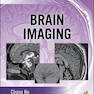 Radiology Case Review Series: Brain Imaging 1st Edition