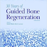 30Years of Guided Bone Regeneration in Implant Dentistry