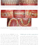 ارتودنسی نوین پروفیت 2019 جلد 1