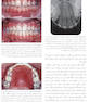 ارتودنسی نوین پروفیت 2019 جلد 2