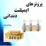 پروتزهای ایمپلنت دندانی میش جلد 2 Misch 2015