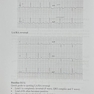 برترین و تخصصی ترین نکات آموزش نوار قلب Einthoven ECG ( بر پایه آخرین مقالات و منابع معتبر ) جلد 1 مقدماتی
