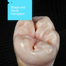 Posterior Direct Restorations 1st Edition