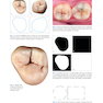 Posterior Direct Restorations 1st Edition