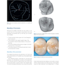 Posterior Direct Restorations 1st Edition