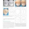 Posterior Direct Restorations 1st Edition