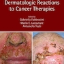Dermatologic Reactions to Cancer Therapies2019واکنشهای پوستی به درمانهای سرطان