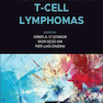 The Peripheral T-Cell Lymphomas2021لنفوم های سلول T محیطی