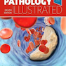 Pathology Illustrated52018آسیب شناسی