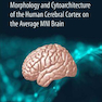 Atlas of the Morphology of the Human Cerebral Cortex on the Average MNI Brain