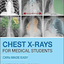 Chest X-Rays for Medical Students: CXRs Made Easy 2nd Edition2020
