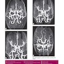 Weir - Abrahams’ Imaging Atlas of Human Anatomy