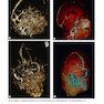 Weir - Abrahams’ Imaging Atlas of Human Anatomy