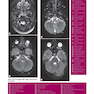 Weir - Abrahams’ Imaging Atlas of Human Anatomy