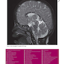 Weir - Abrahams’ Imaging Atlas of Human Anatomy