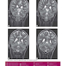 Weir - Abrahams’ Imaging Atlas of Human Anatomy