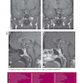 Weir - Abrahams’ Imaging Atlas of Human Anatomy