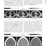 CT Teaching Manual: A Systematic Approach to CT Reading 5. Edicion