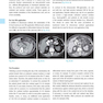 CT Teaching Manual: A Systematic Approach to CT Reading 5. Edicion