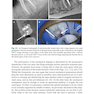 Shaping for Cleaning the Root Canals : A Clinical-Based Strategy 2022