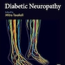 Diabetic Neuropathy 1st Edición