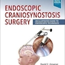Endoscopic Craniosynostosis Surgery : An Illustrated Guide to Endoscopic Techniques