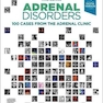 Adrenal Disorders : 100 Cases from the Adrenal Clinic