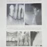 مرجع و اطلس رنگی آسیب های تروماتیک وارده به دندان ها - اندریاسن  (جلد دوم)