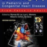 Echocardiography in Pediatric and Congenital Heart Disease, 2nd Edition2016 اکوکاردیوگرافی در بیماری های قلب و مادرزادی قلب