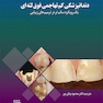 دندانپزشکی کم تهاجمی فوق لثه ای یک رویکرد سالم تر در ترمیم های زیبایی