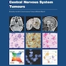 Central Nervous System Tumours (WHO Classification of Tumours) 5th Edición