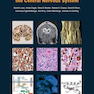 Classification of Tumours of the Central Nervous System, 4th Edition2016 WHO طبقه بندی تومورهای سیستم عصبی مرکزی