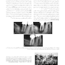 اصول و درمان اندودانتیکس ترابی نژاد 2021 چاپ سیاه و سفید