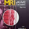 تکنیک های تصویربرداری در MRI وست بروک