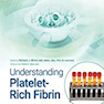 Understanding Platelet-Rich Fibrin2021