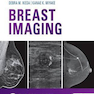 Breast Imaging: The Requisites
