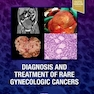 Diagnosis and Treatment of Rare Gynecologic Cancers